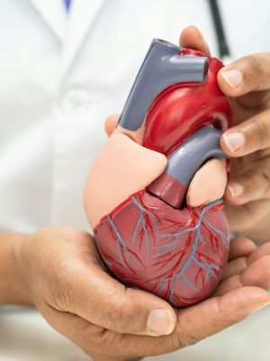 Cardiovascular disease CVD, Asian doctor holding human anatomy model for learn and treat heart.